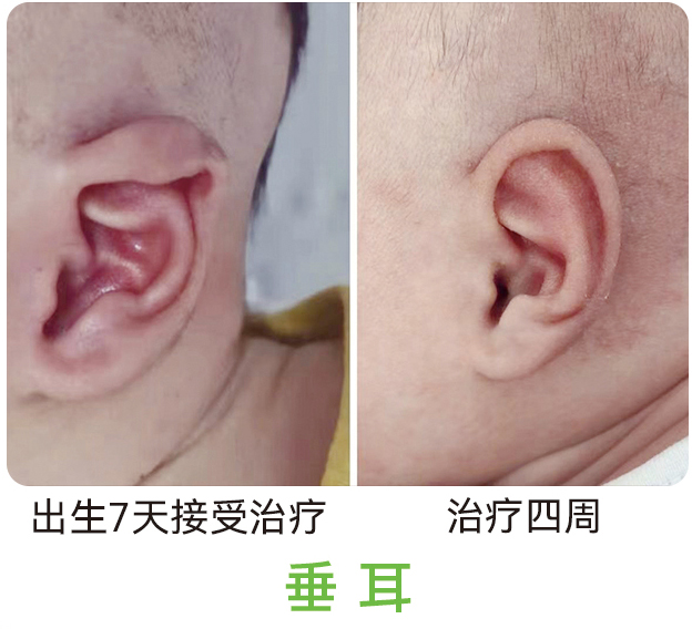 垂耳
